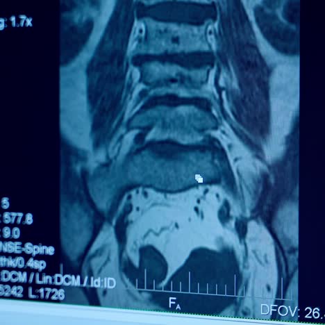 monitors showing scans results. close up of scan screen animation monitor