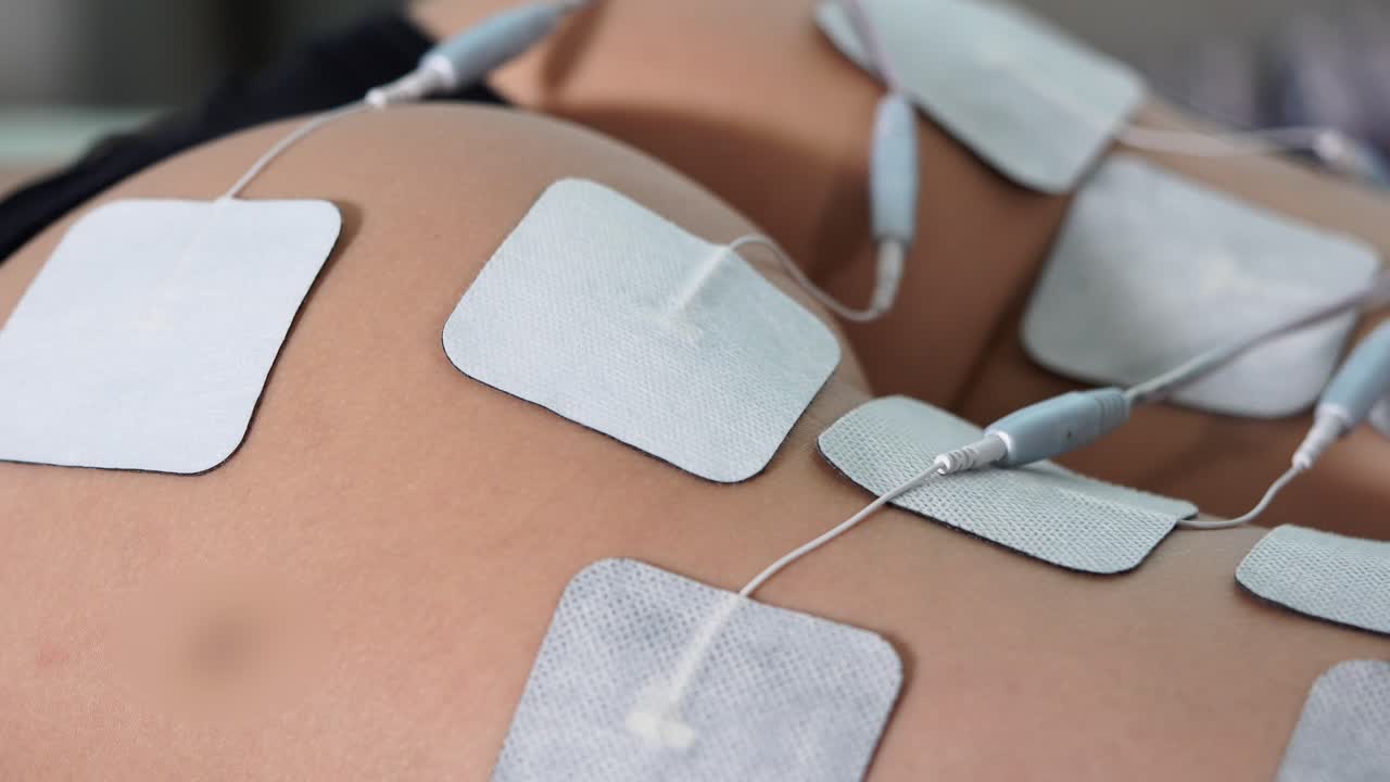 Electrostimulation Treatment on Buttocks and Legs