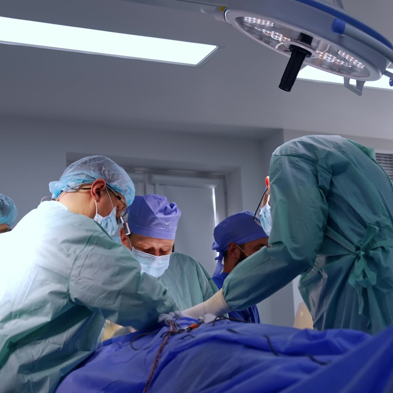 Un gruppo di medici circonda il tavolo operatorio. Neurochirurghi eseguono microchirurgia in una sala operatoria moderna. Angolazione dal basso