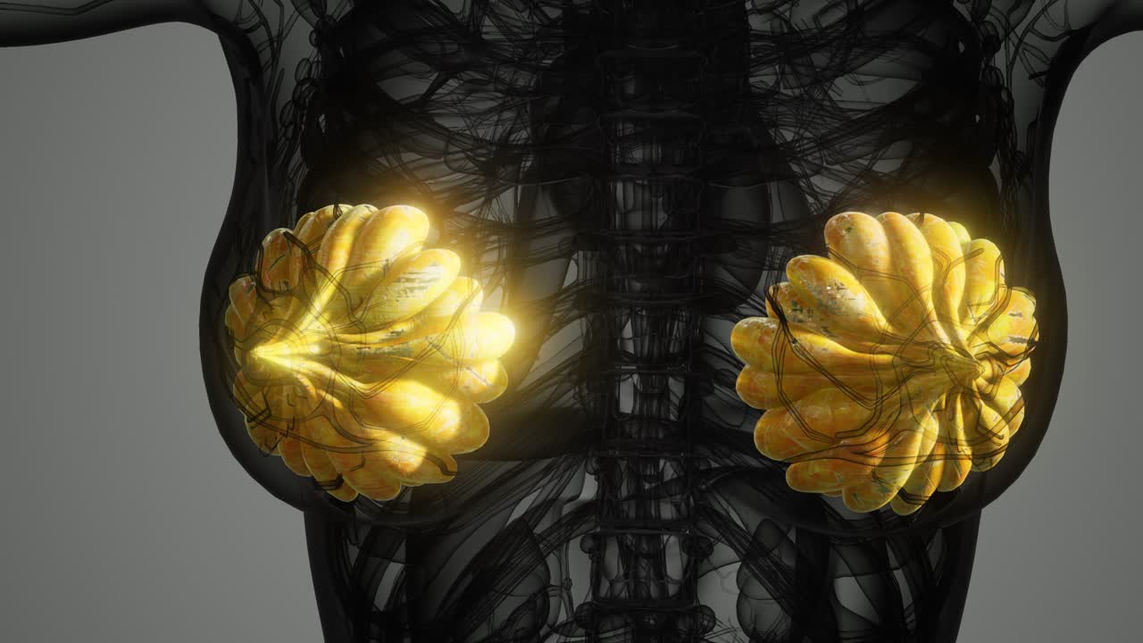 여성 유방암 의 의학적 검사