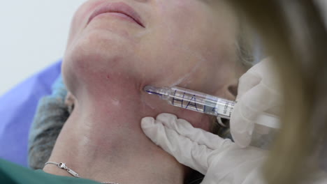 las manos de una doctora inyectando botox con una jeringa en la barbilla de una mujer.