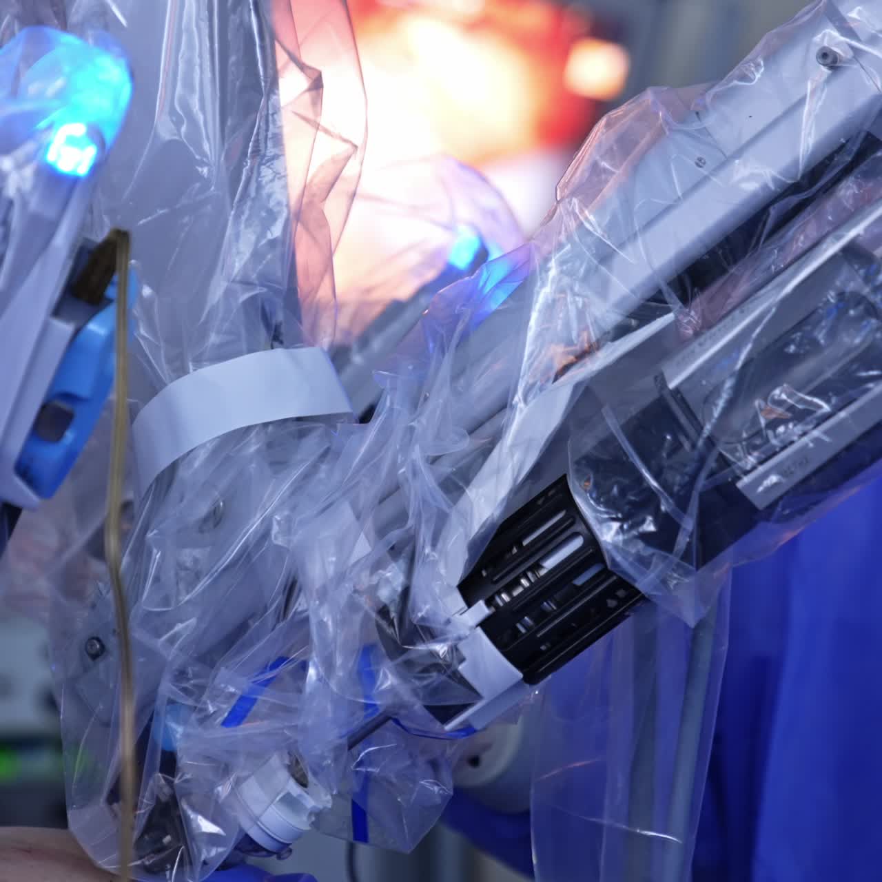 Da Vinci innovative equipment operating the patient. Plastic covered robotic arms move inserted in abdomen. Close up