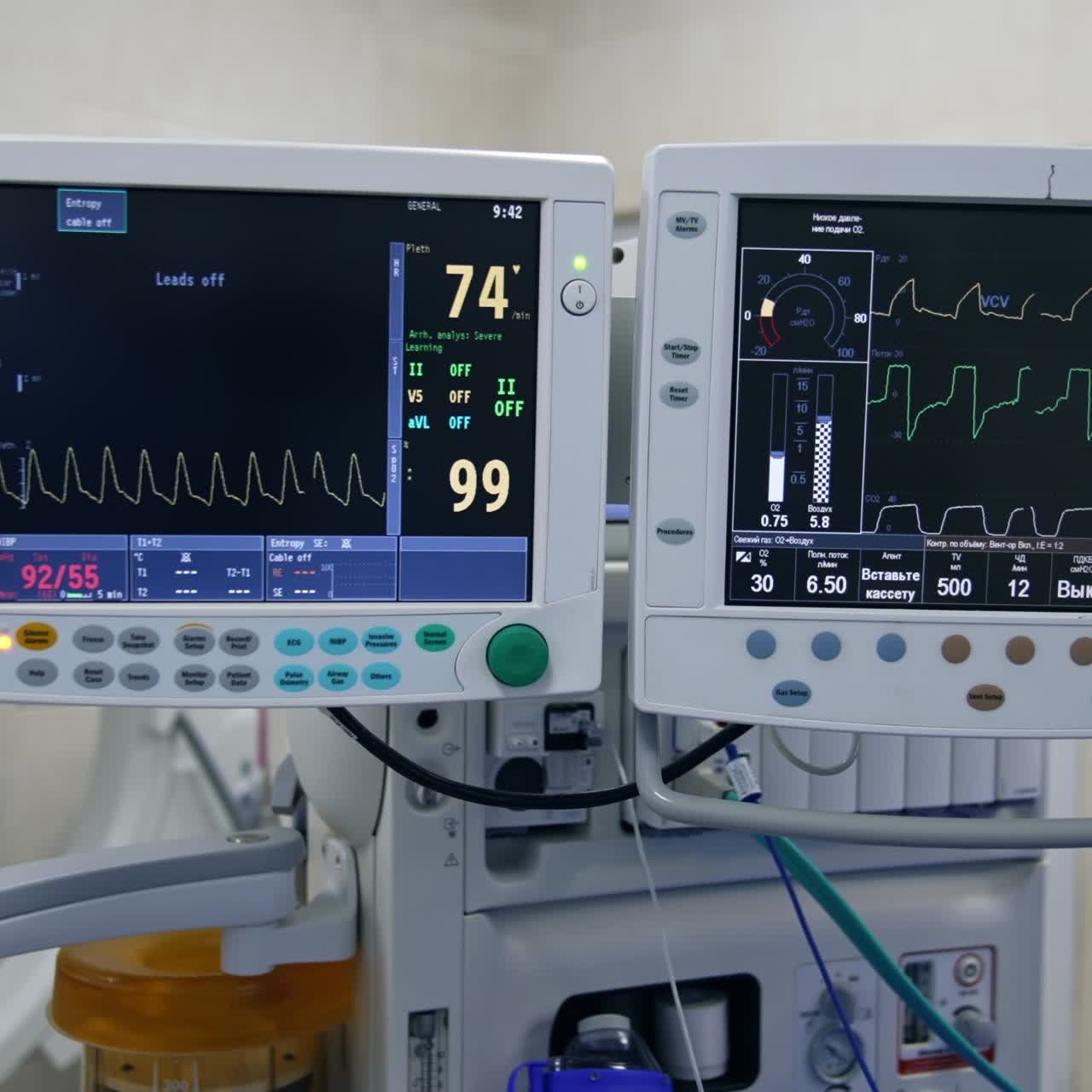 Advanced modern system of artificial lung ventilation working in surgery room. Two black screens with life signs of a patient. Close up