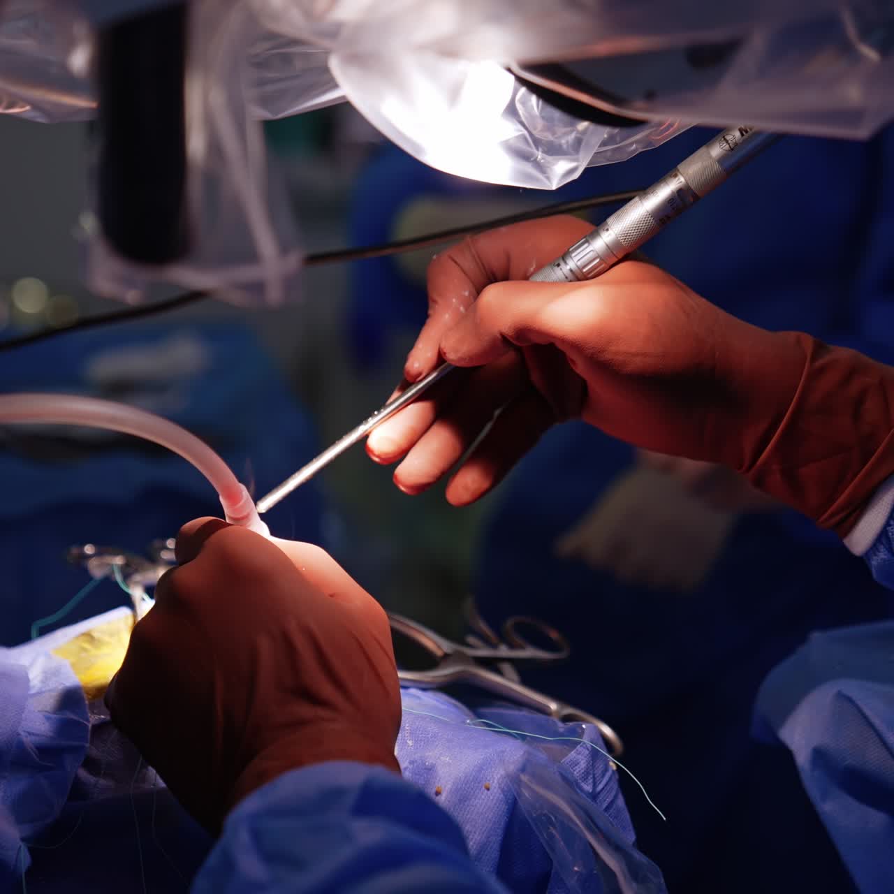 Doctor's hands apply advanced medical tools at neurosurgery. Close up view of an operational spot in modern hospital