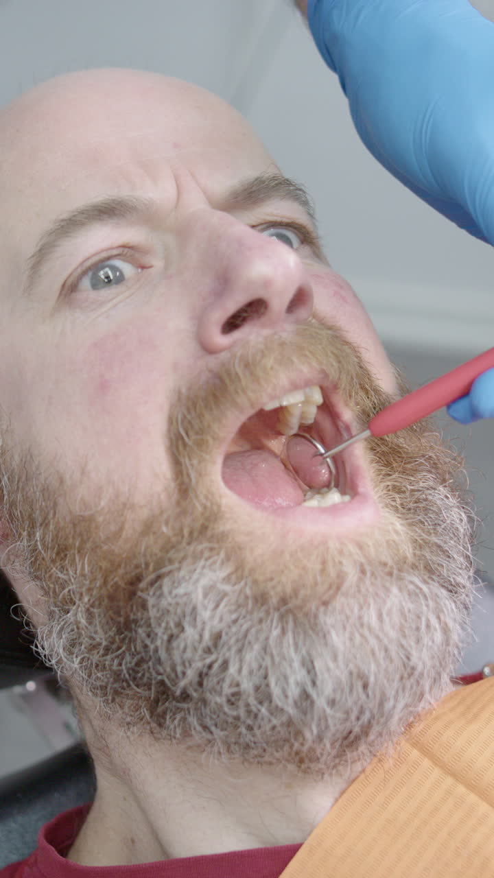 Man with dentophobia opens mouth as dentist insert forceps, funny face. Vertical