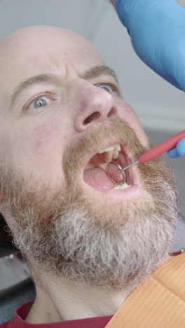 man with dentophobia opens mouth as dentist insert forceps, funny face. vertical