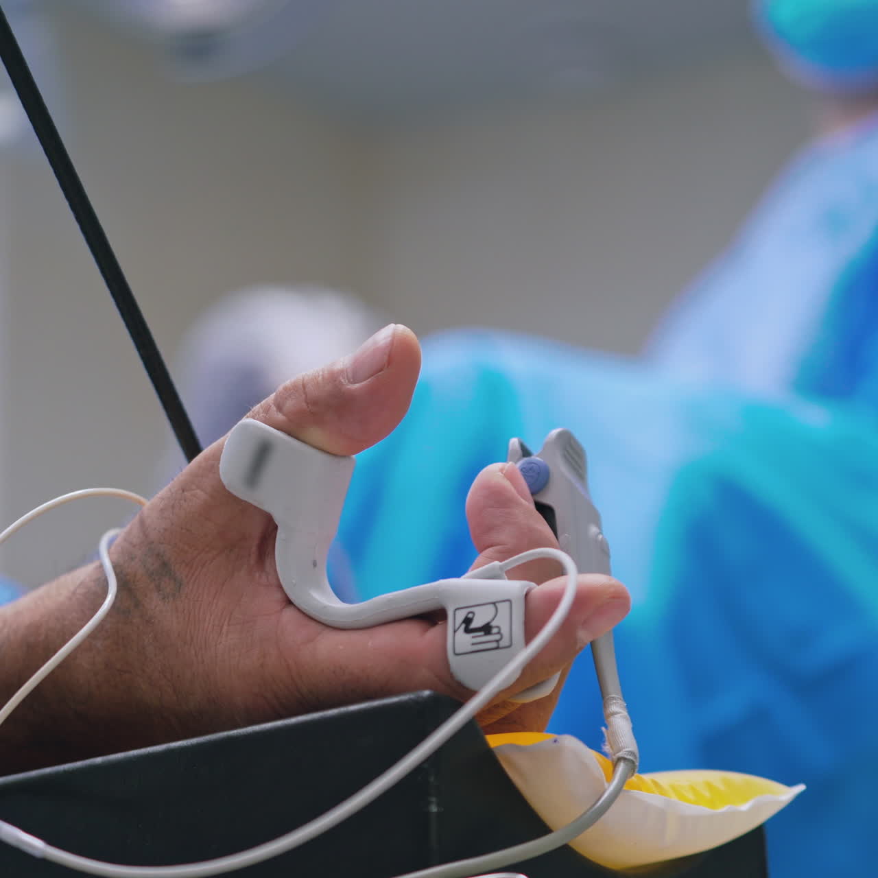 Laparoscopic operation. Hand of a patient with many tubes. Close-up of man's hand during the operation on the blur background of a surgeon in clinic.