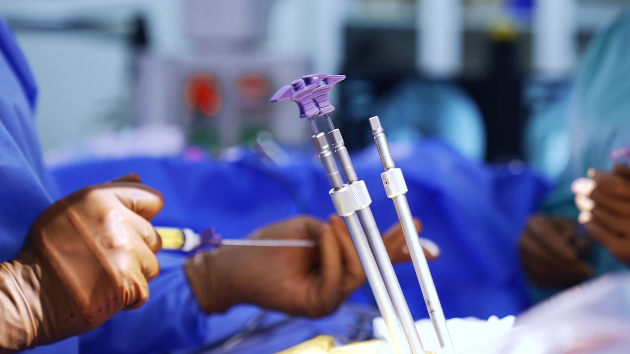 Primo piano di un chirurgo che inietta un fluido con una siringa durante una procedura medica.