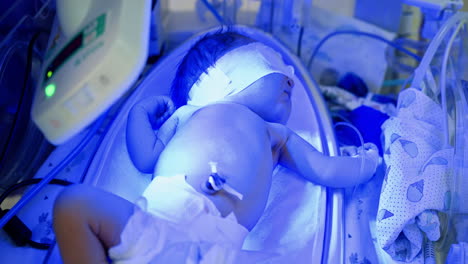 baby in neonatal intensive care unit