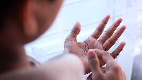 Close-up-of-dry-cracked-skin-of-a-mens-hand-,