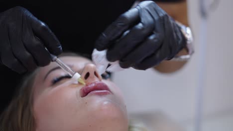 close-up of a lip augmentation procedure using an injection