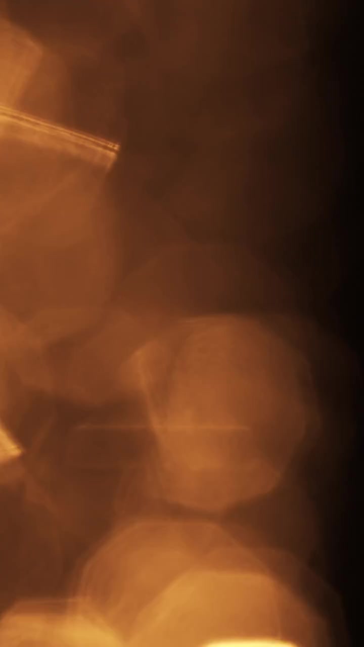 Sovrapposizione Astratta Bokeh di Luce Dorata su Sfondo Nero