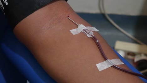 an arm of person while donating blood at a transfusion center