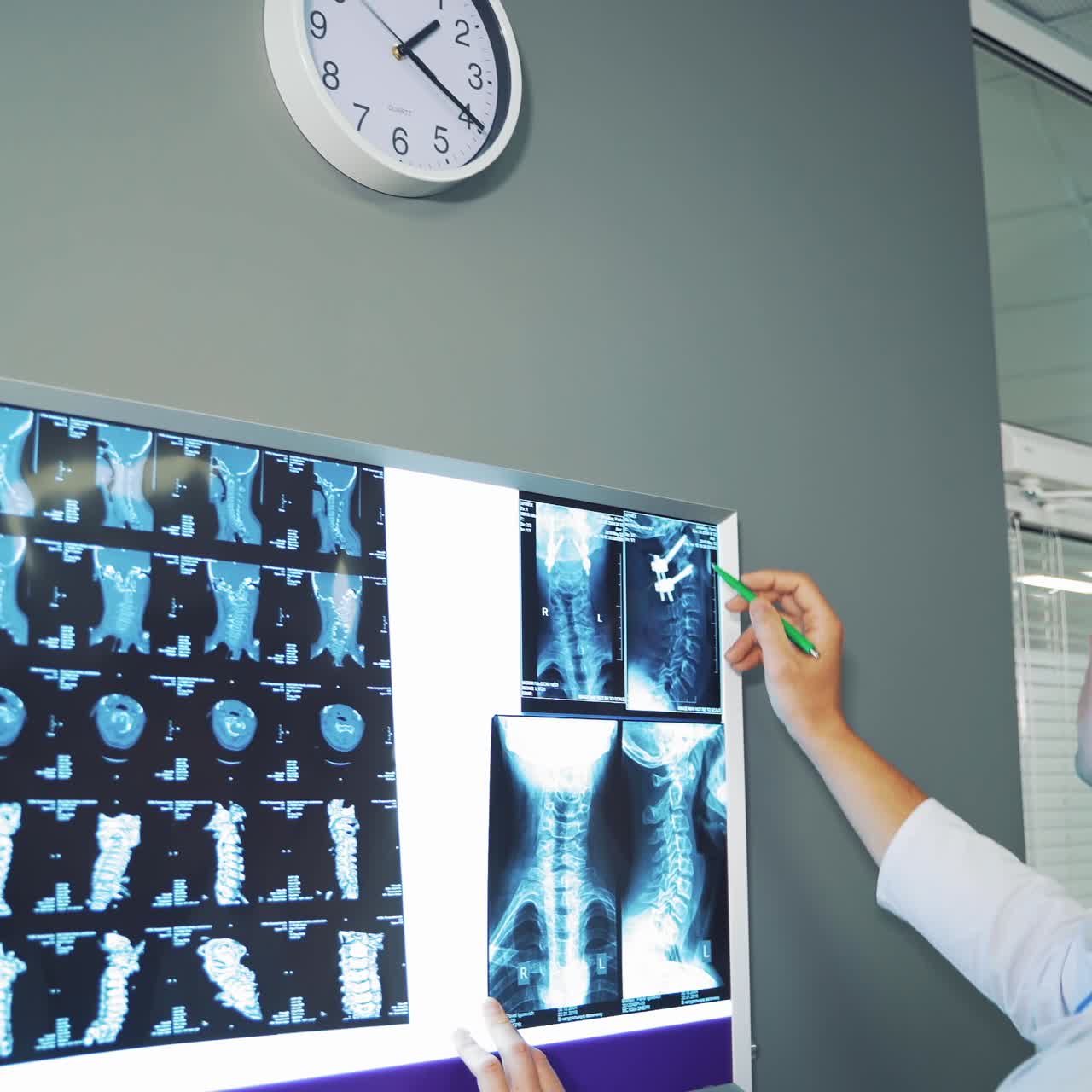 Male doctor in medical clinic examining x ray