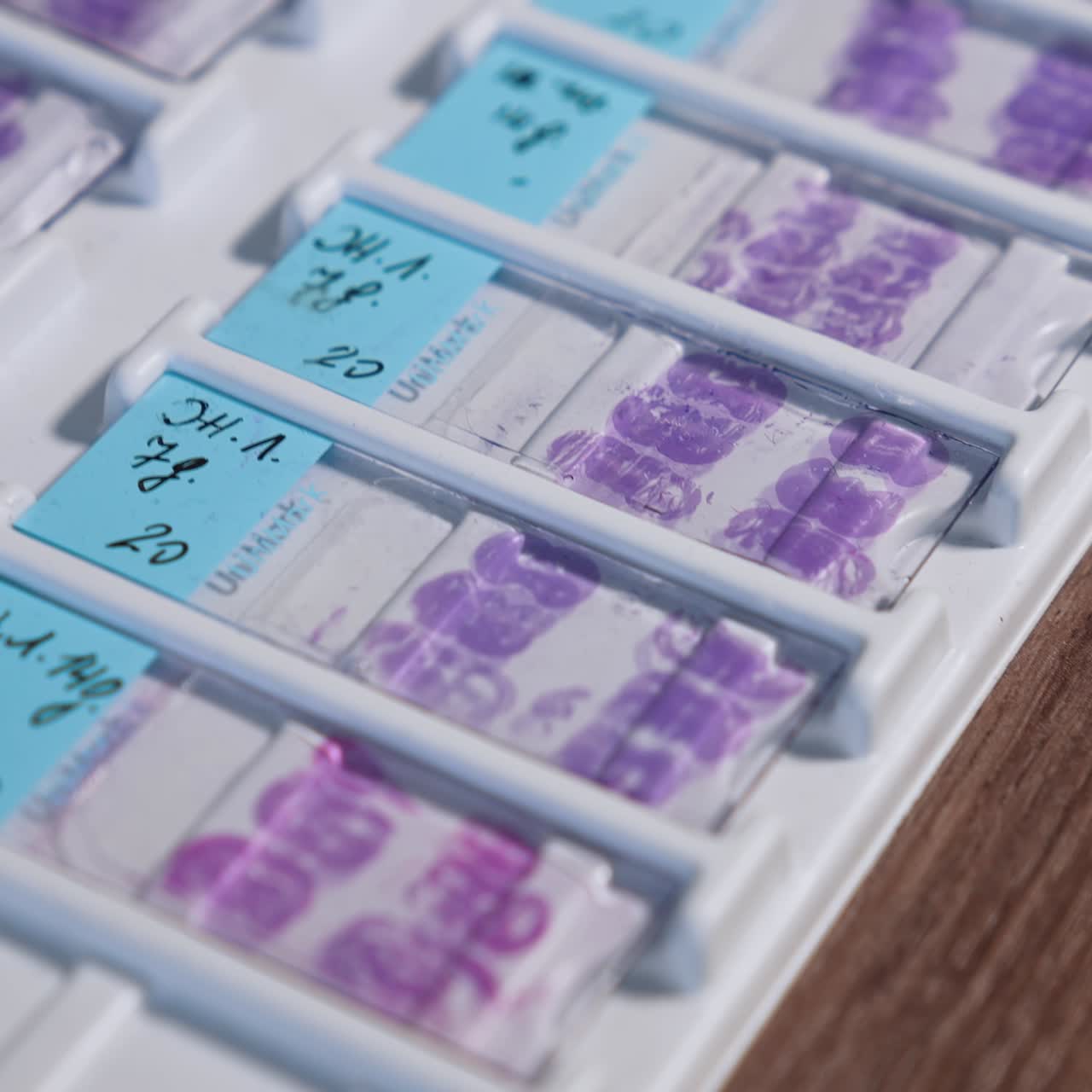 Close up view of medical test analysis. Science laboratory researchment