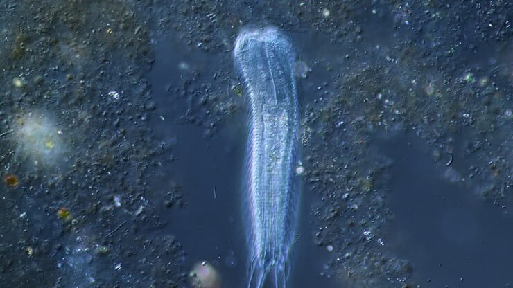 Microscopic View of a Stentor Ciliate Moving in Pond Water
