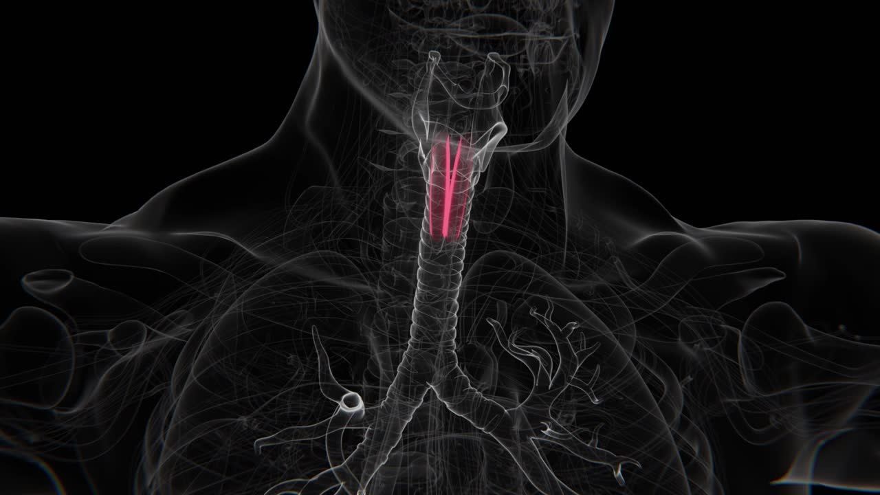 Video a raggi X di laringotracheite crupale in un neonato | Video di laringotracheite crupale ai raggi X | Video di indicazione di laringotracheite crupale in formato HD