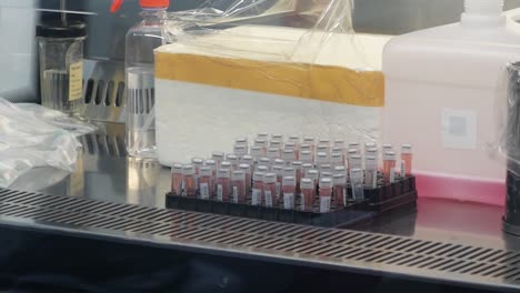 multiple blood collection tube on rack,  medium shot