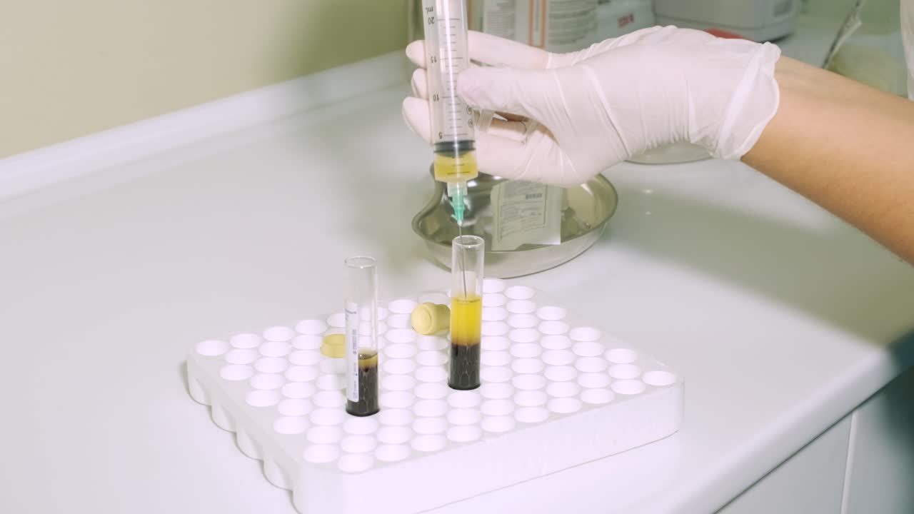 혈소판이 풍부한 플라즈마 준비: 주사기에 있는 플라스마, 원심분리기, 배경