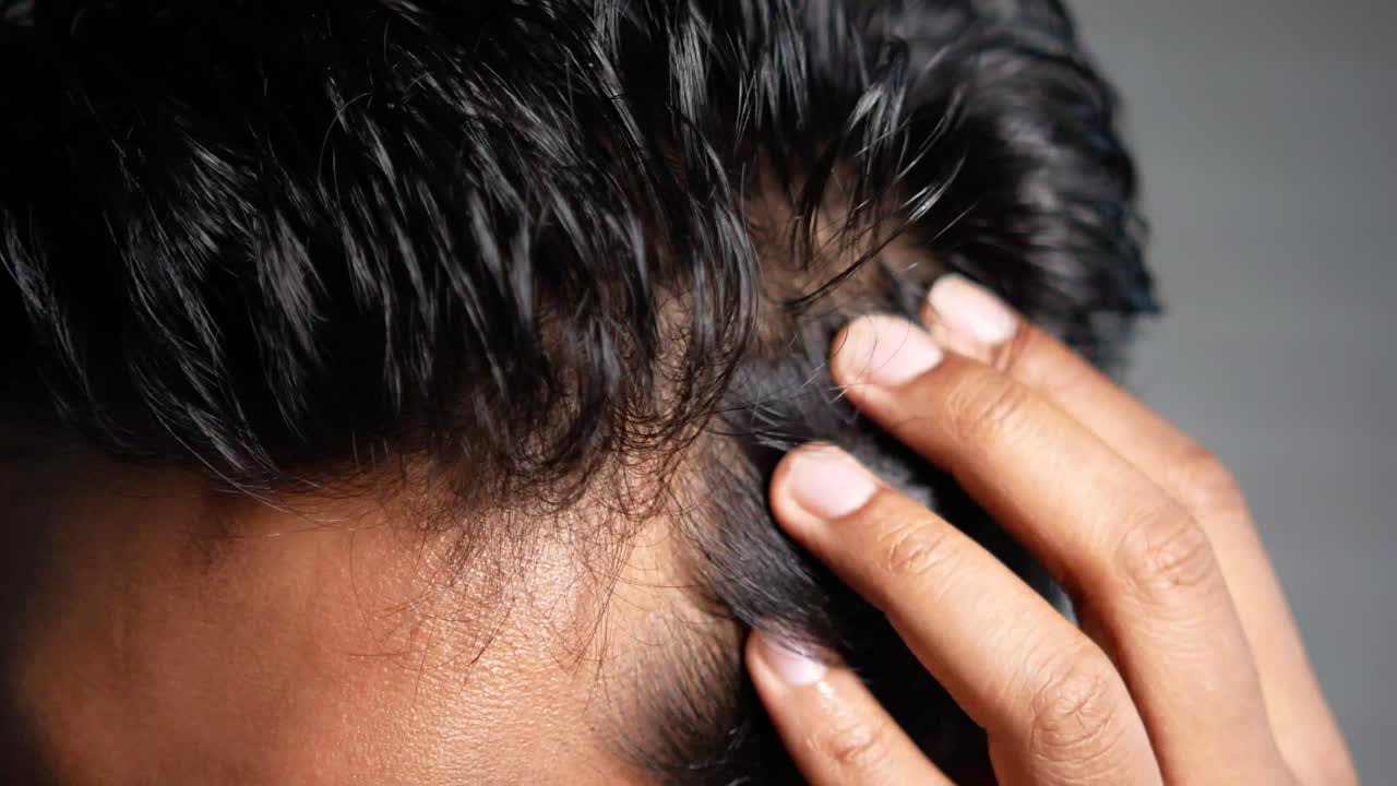 머리카락이 빠지고 아지는 것