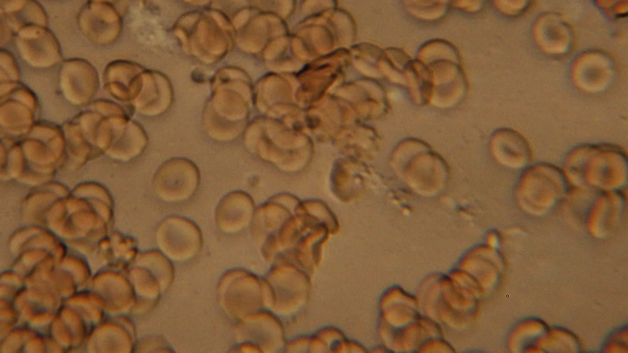 Immagine microscopica che mostra globuli rossi raggruppati con forme rotonde distinte, simili a dischi, visti ad alto ingrandimento. Ideale per contesti medici o scientifici.