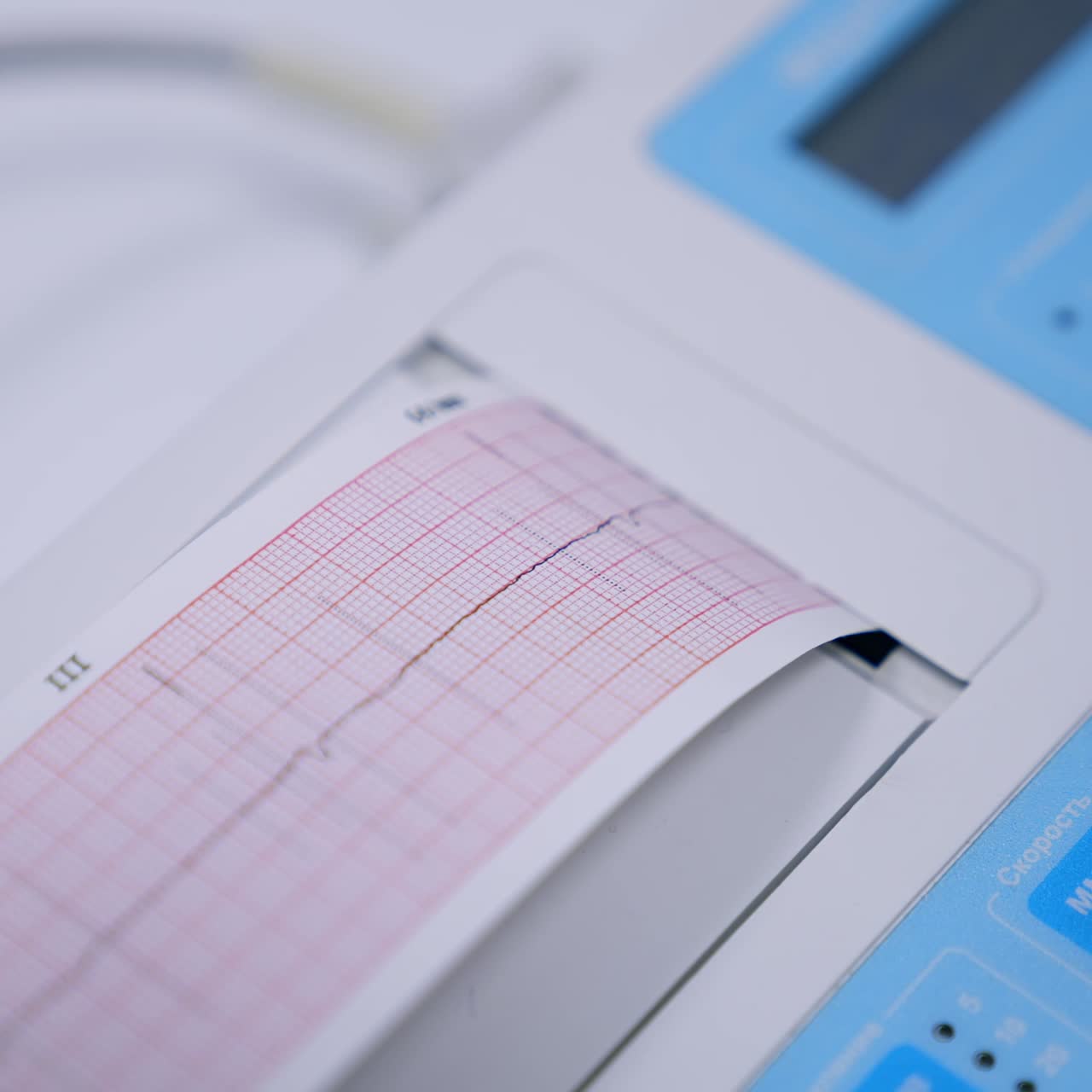 Heart check up result produced by electrocardiograph. Close up. Medical equipment working in hospital