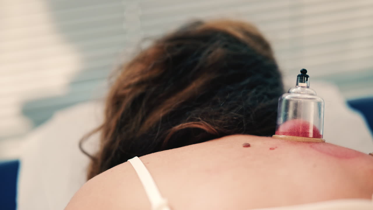 Close up of vacuum cupping therapy being applied to a woman's upper back in a clinical wellness setting