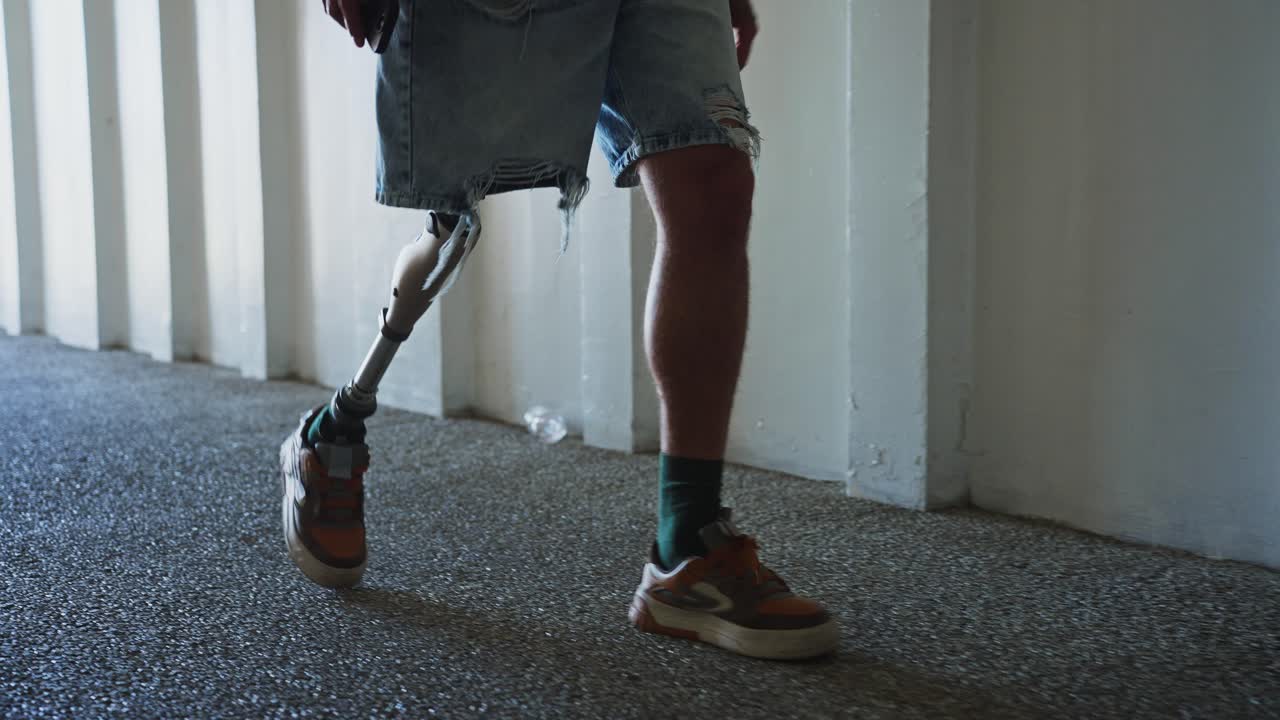 Person with Prosthetic Leg Walking in a Hallway