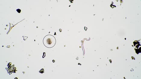 el nematodo se está retorciendo cerca del huevo perfectamente redondo del otro microorganismo