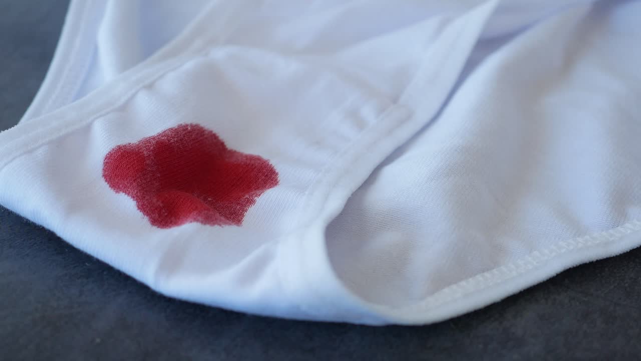 mancha de sangre en la ropa interior blanca