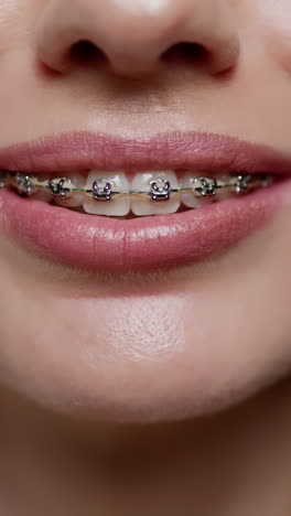 woman with braces