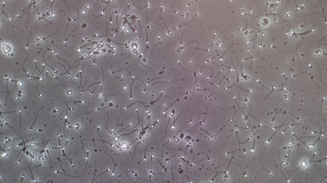 Spermatozoa cells moving in a fluid, representing human fertility, reproduction, and sperm health analysis in a laboratory