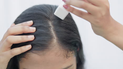 collagen induction therapy, microneedling treatment, a woman using derma stamp on scalp to treat hairloss.
