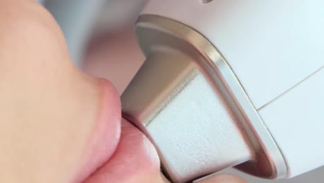 laser hair removal treatment