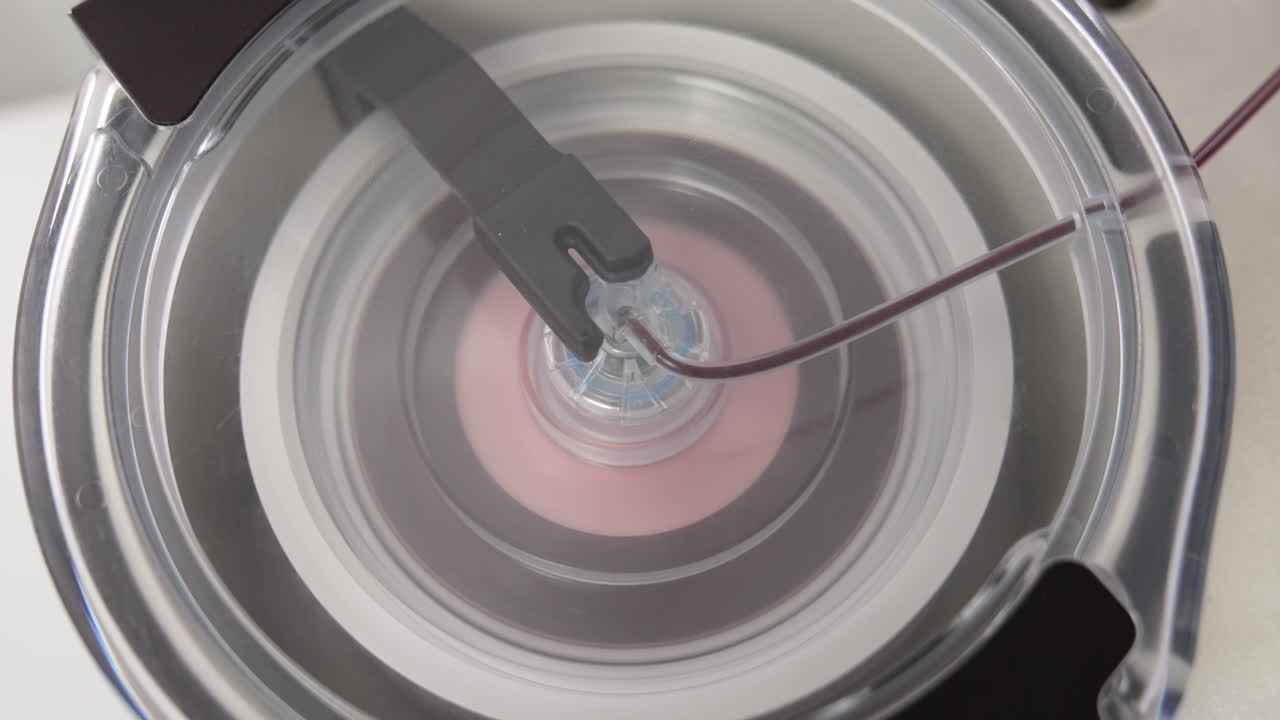 Blood flows by the thin tube to the centrifuge machine. Close up. Extracting plasma process.