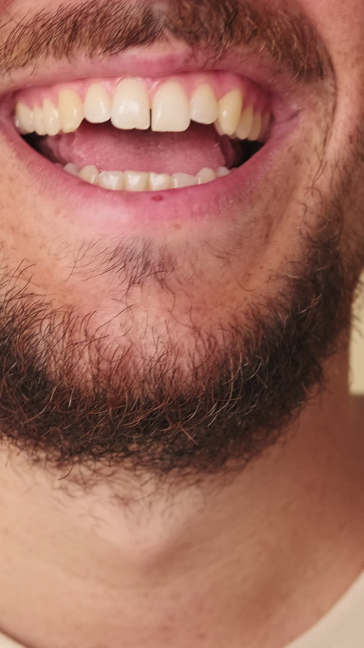 Close-up of a Smiling Man with a Beard Laughing