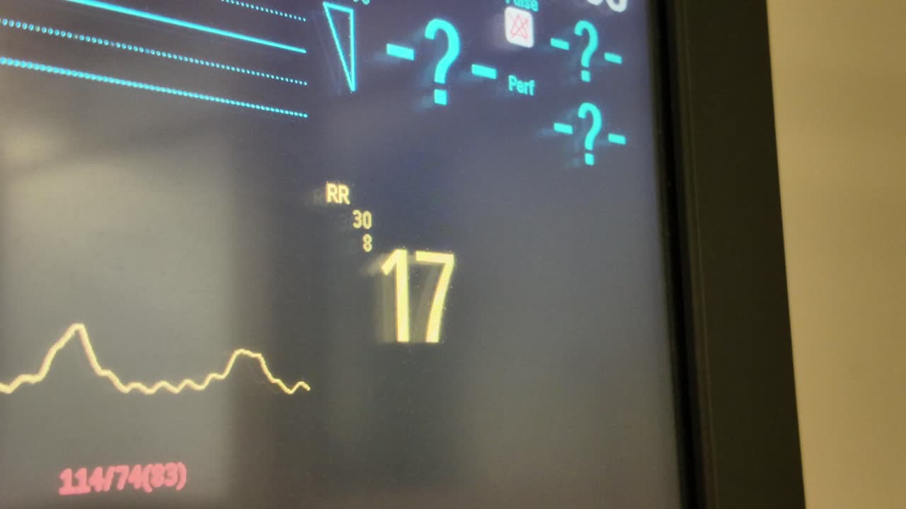 Vital Signs Monitor Display