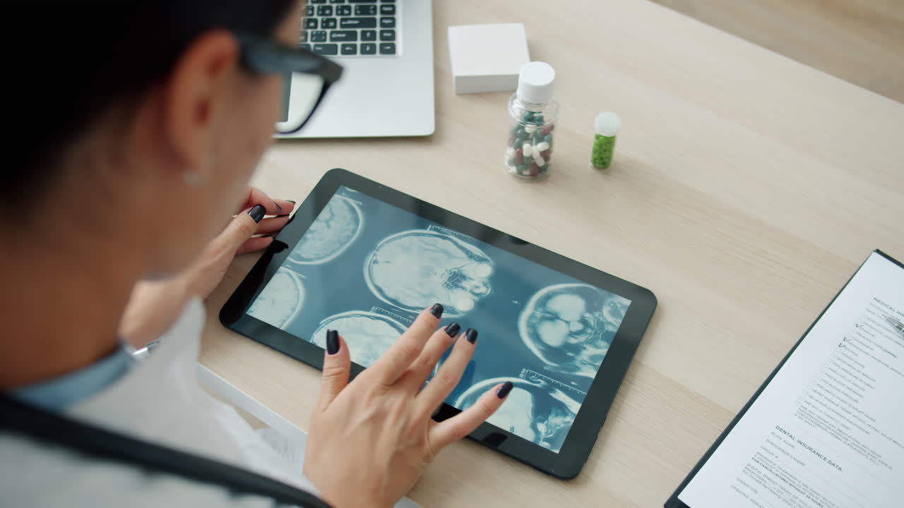 Doctor Reviewing MRI Scans on Tablet