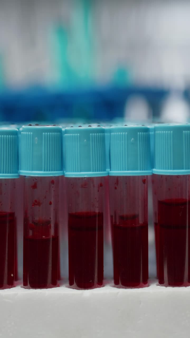 Vertical video Close up of small glass flasks containing red blood samples on lab workbench