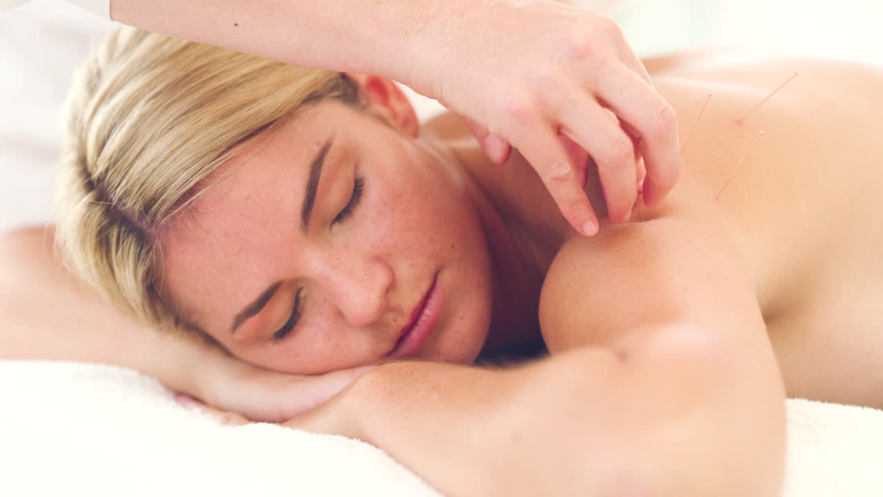 침술 치료를 받고 있는 젊은 여성