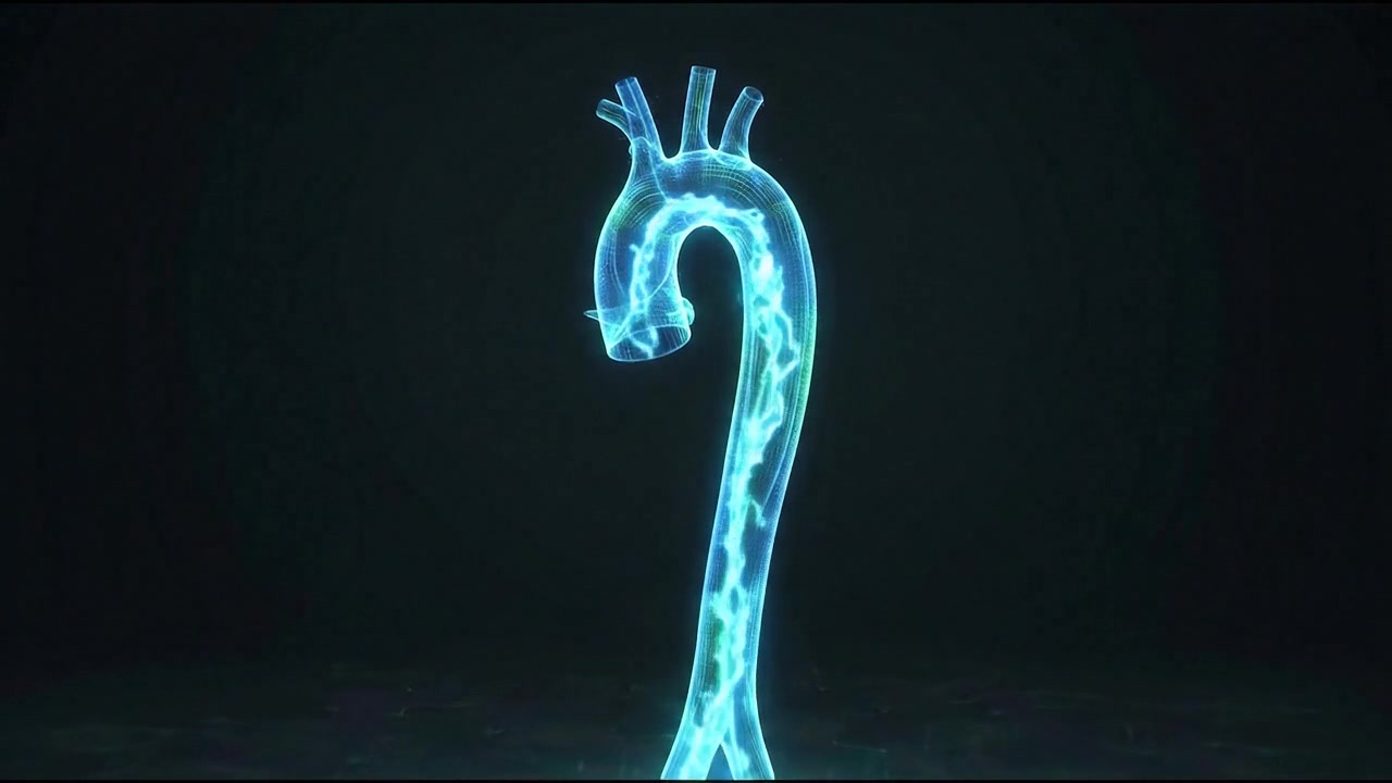 Ologramma 3D di una sezione intestinale del tratto digestivo umano