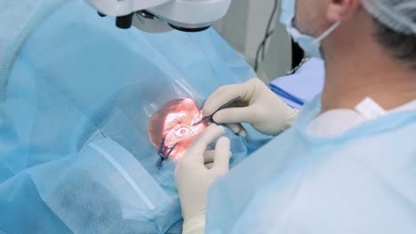 ophthalmological surgery specialist sits in front of microscope performing operation. low angle view on the female doctor conducting high-precision surgery. femto laser assisted cataract surgery. cataract surgery. ophthalmic operation