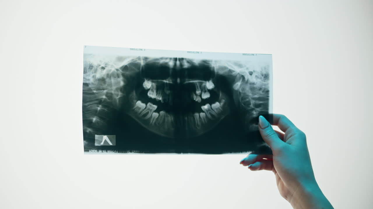 Close-Up of Hand Holding Panoramic Dental X-Ray