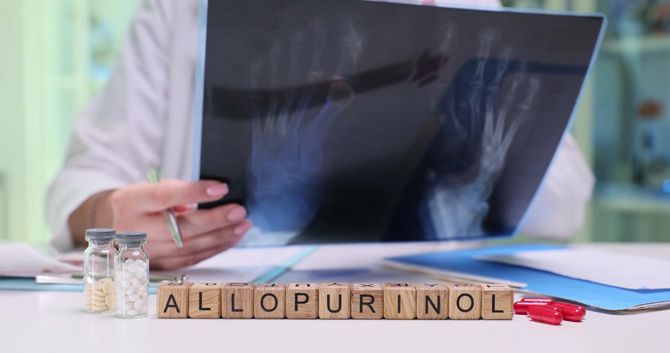 The doctor is analyzing the xray results while considering an allopurinol treatment plan