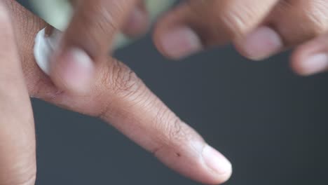 applying cream to a cut finger