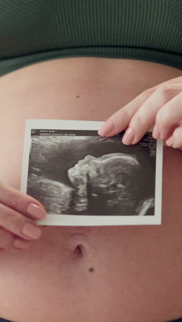 a pregnant woman holding an ultrasound picture of her baby