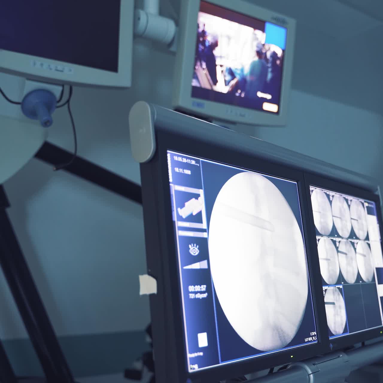 Advance ultrasound machine in hospital