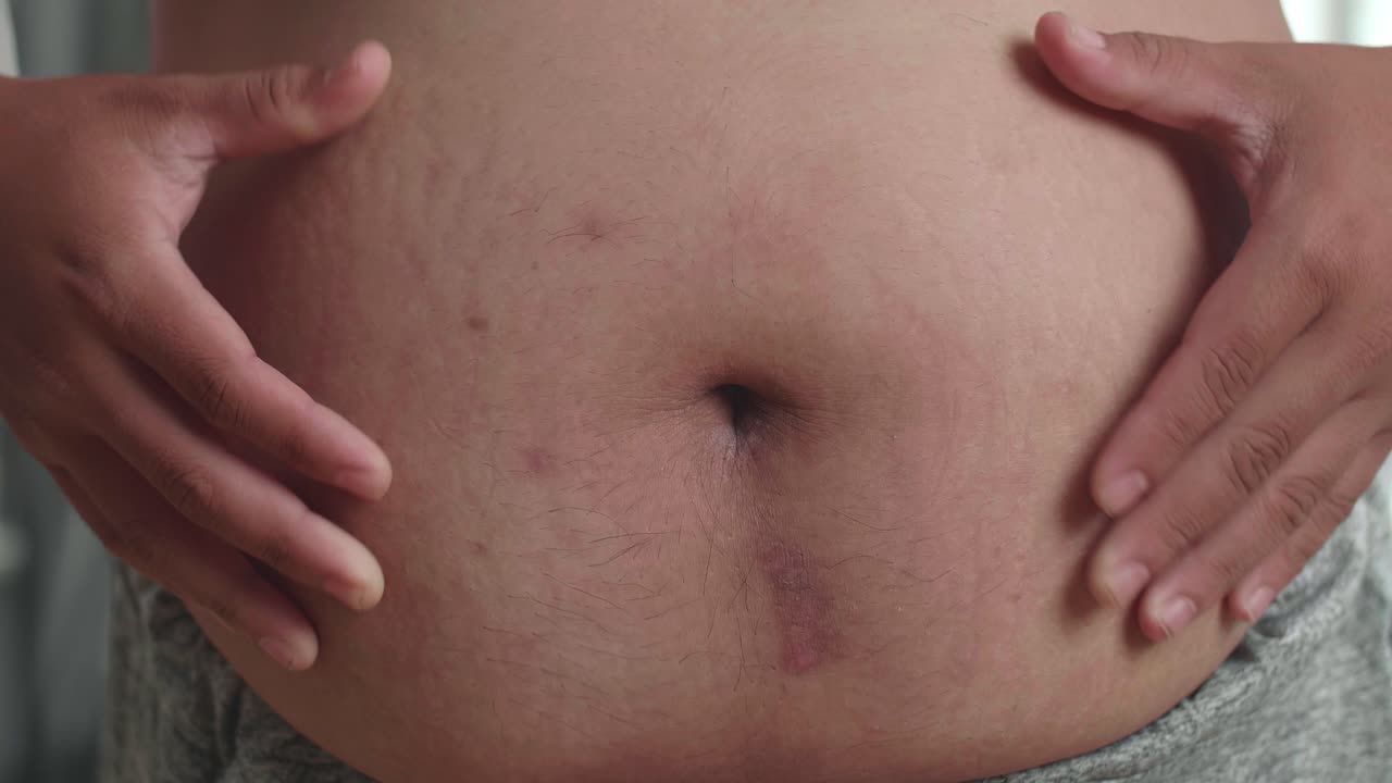 cerca de hombre gordo exprimir la grasa del vientre que alrededor