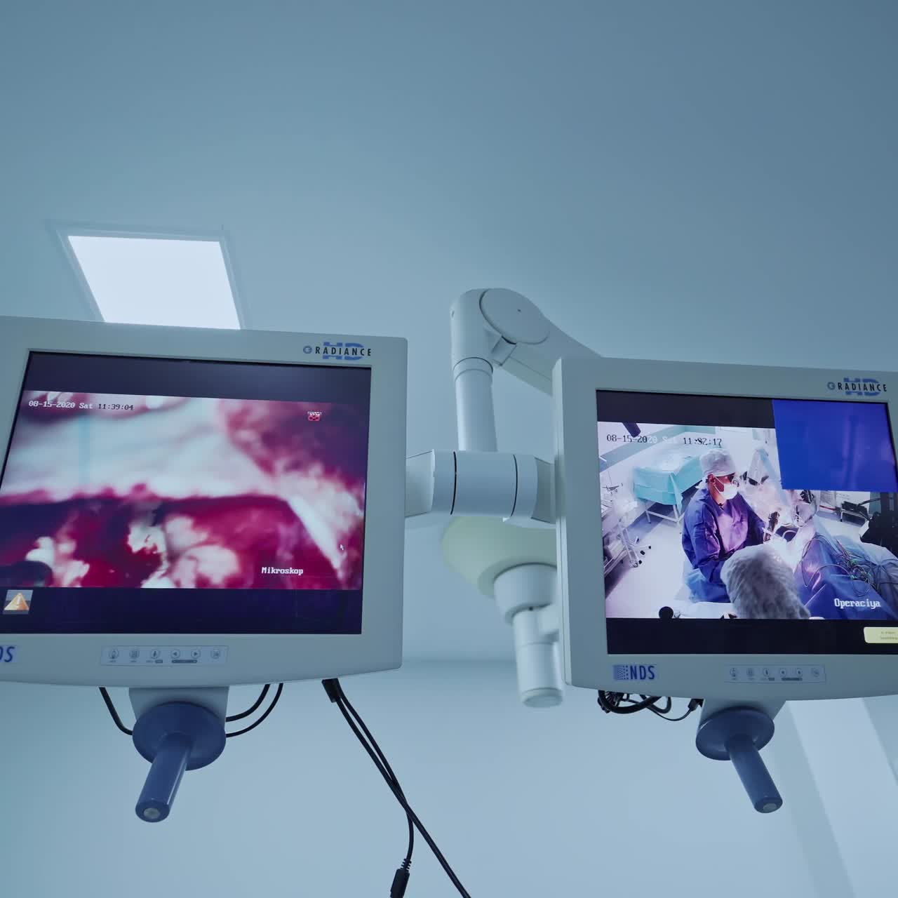 Operation with laparoscopic equipment