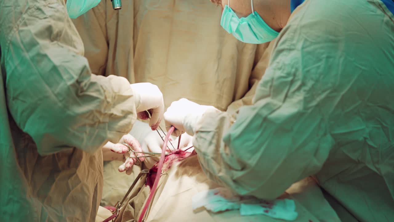 three doctors conduct a patient operation with the participation of a nurse in the operating room in the hospital. Close-up